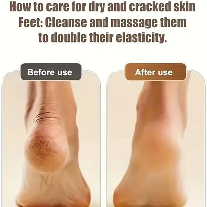 Rechargeable Electric Foot File & Callus Remover – 3 Grinding Heads, Pedicure Tool for Dead, Hard & Cracked Skin