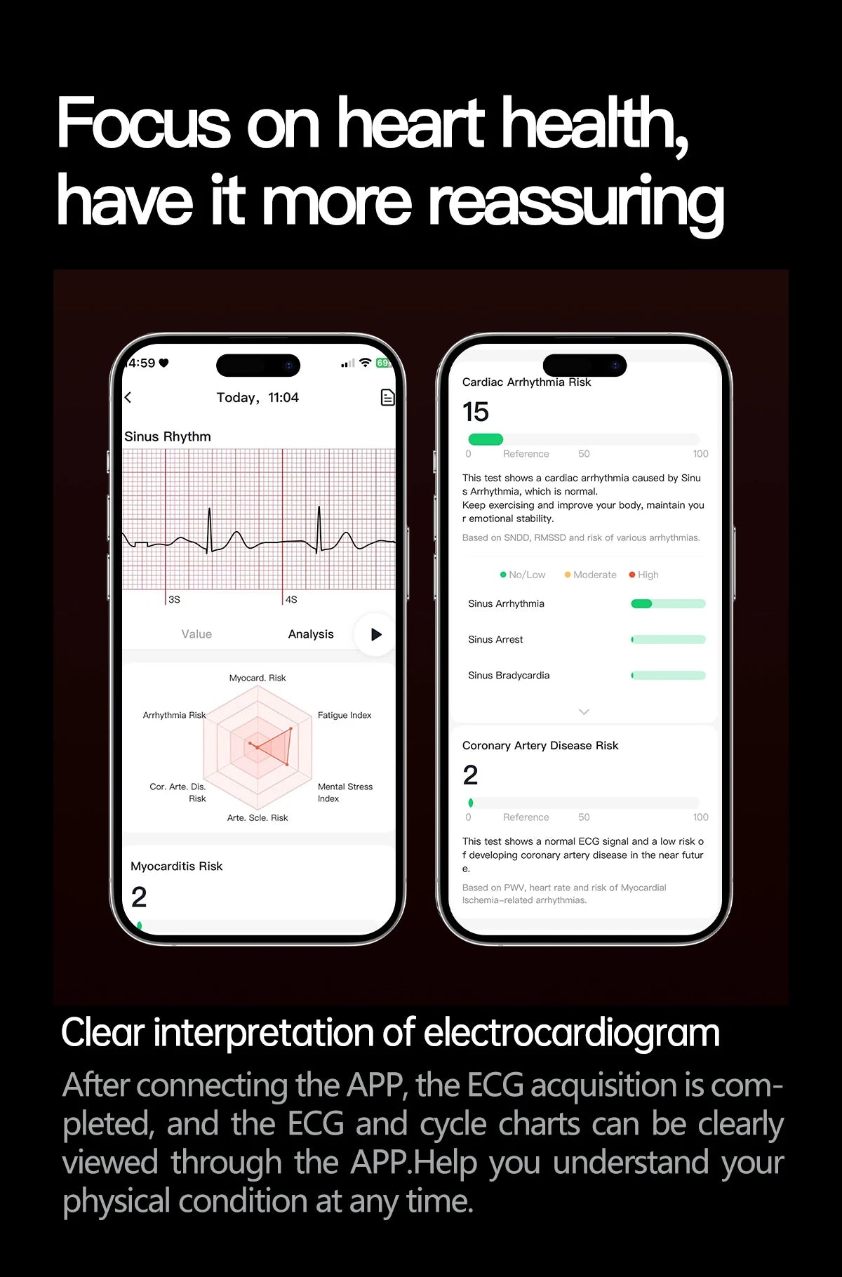 2025 Health Smart Watch – ECG+PPG, Blood Pressure, Blood Oxygen, Uric Acid, Bluetooth Call