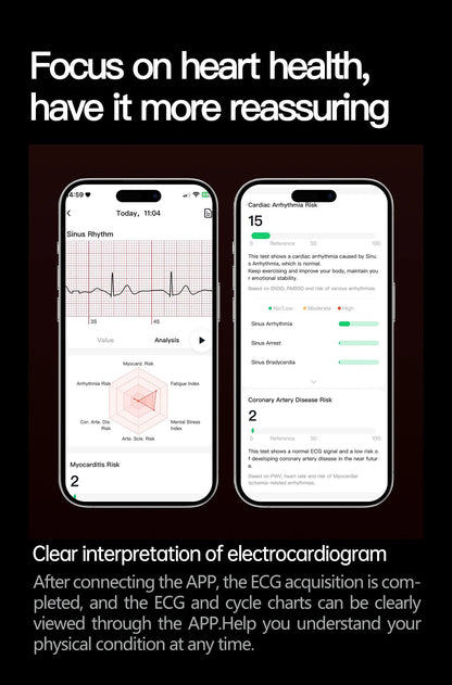 2025 Health Smart Watch – ECG+PPG, Blood Pressure, Blood Oxygen, Uric Acid, Bluetooth Call