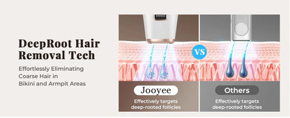 JOOYEE IPL Hair Removal Device – 999,900 Flashes, 9 Levels, HR/SC/RA Modes, Painless At-Home Laser Epilator for Women