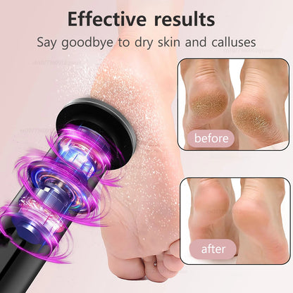 Electric Foot File Rechargeable – Pedicure Callus & Dead Skin Remover for Heels