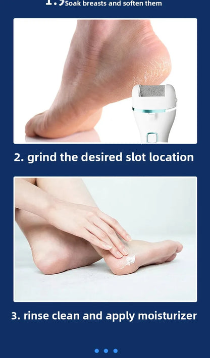 Electric Foot Callus Remover | Pedicure Machine | Rechargeable Foot Grinder