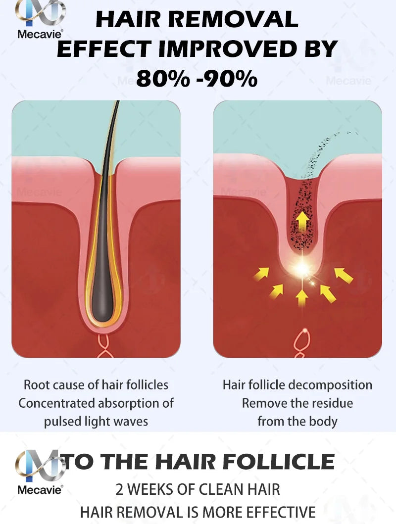 Professional 4-Wave 808nm Diode Laser Hair Removal | 4000W Soprano Titanium | Face & Body