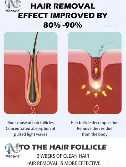 Professional 4-Wave 808nm Diode Laser Hair Removal | 4000W Soprano Titanium | Face & Body