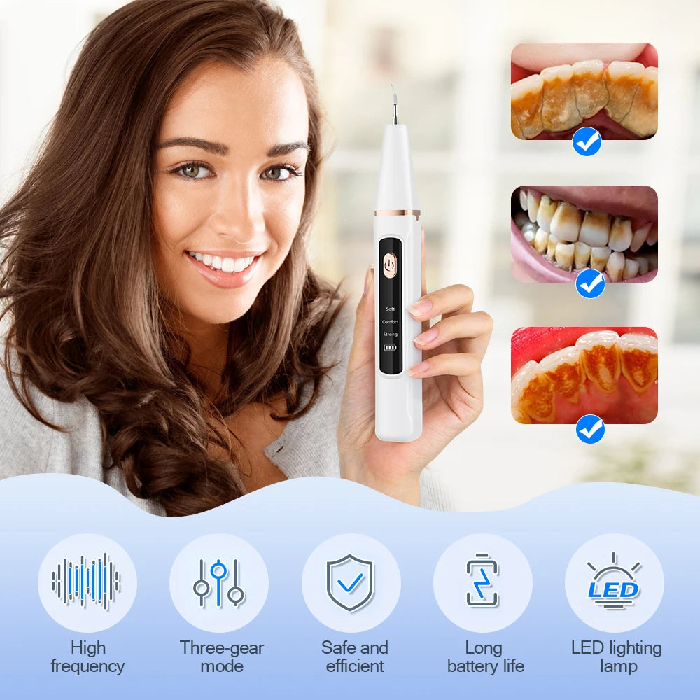 Ultrasonic Water Flosser – Tartar Remover, Stain Eraser, Multi-Mode, Type-C Rechargeable, Portable Oral Care