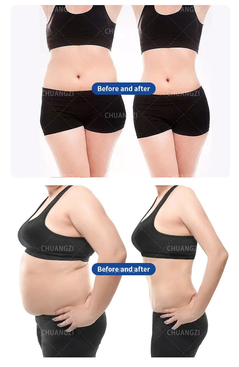 EMS Mini 200Hz Body Sculpting Machine – RF + Muscle Stimulation, Fat Burning, Electromagnetic Slimming