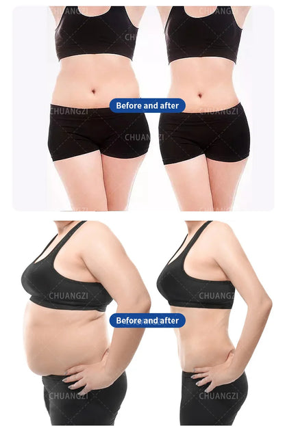 EMS Mini 200Hz Body Sculpting Machine – RF + Muscle Stimulation, Fat Burning, Electromagnetic Slimming