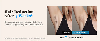 JOOYEE IPL Hair Removal Device – 999,900 Flashes, 9 Levels, HR/SC/RA Modes, Painless At-Home Laser Epilator for Women