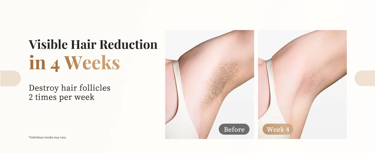 Totmizby 3-in-1 IPL Laser Epilator – 999,900 Flashes, Painless Hair Removal for Face, Body & Bikini
