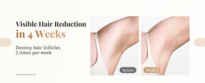 Totmizby 3-in-1 IPL Laser Epilator – 999,900 Flashes, Painless Hair Removal for Face, Body & Bikini