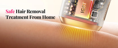 IPL Laser Hair Removal Device – 990,000 Flashes, Painless Permanent Hair Removal for Women & Men