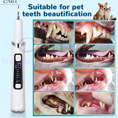 Electric Plaque Remover & Tartar Scraper – LED Light, 2 Replaceable Heads, Dental Teeth Cleaning Kit