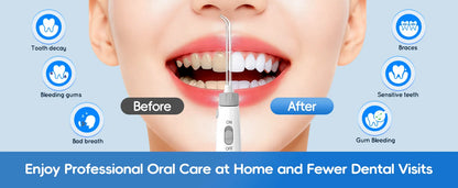 Home Water Flosser 600ml | 10 Pressure Settings | 6 Nozzles | EU Plug | Professional Oral Irrigator
