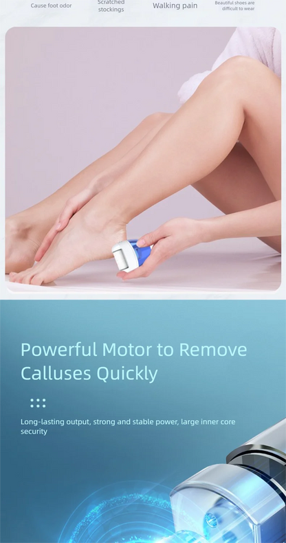 Electric Foot Callus Remover – Rechargeable Pedicure Tool
