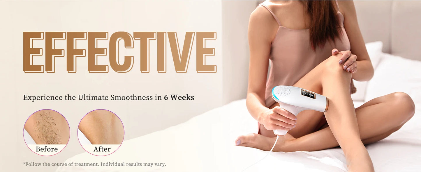 Totmizby 3-in-1 IPL Laser Epilator – 999,900 Flashes, Painless Hair Removal for Face, Body & Bikini