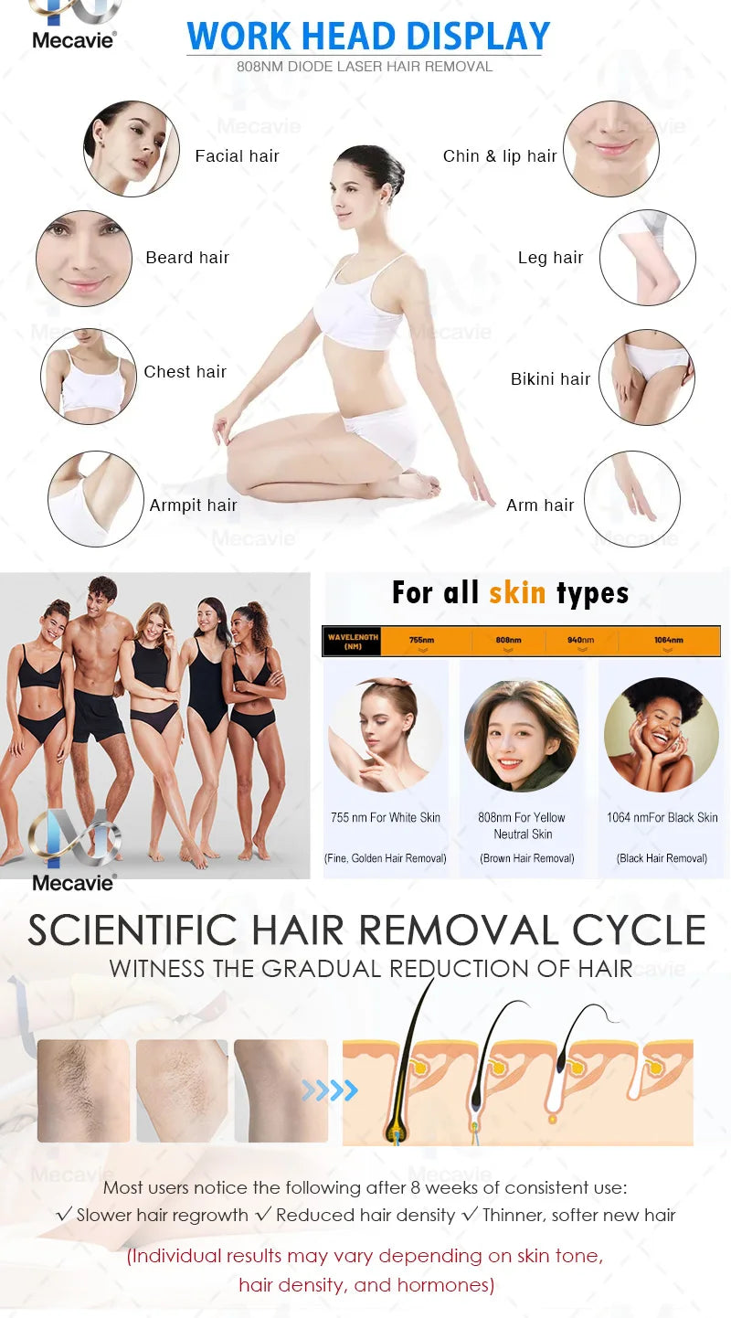 Professional 4-Wave 808nm Diode Laser Hair Removal | 4000W Soprano Titanium | Face & Body