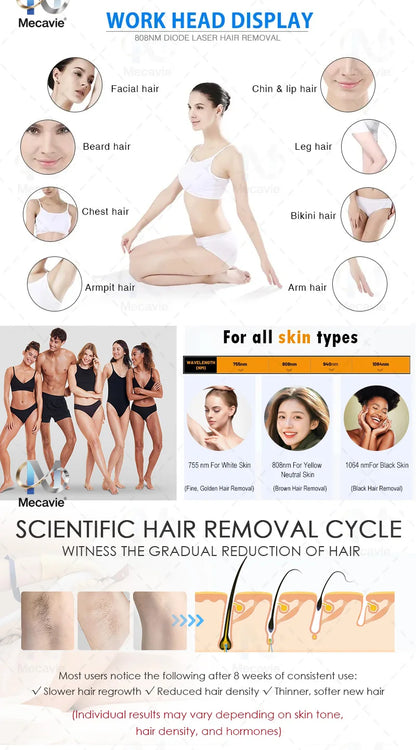 Professional 4-Wave 808nm Diode Laser Hair Removal | 4000W Soprano Titanium | Face & Body