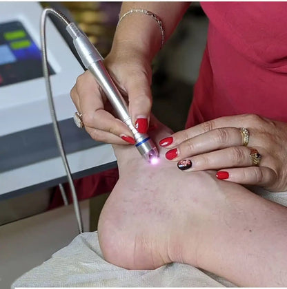 60W 980nm Diode Laser Machine – 6-in-1 Spider Vein & Nail Fungus Removal