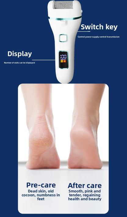 Electric Foot Callus Remover | Pedicure Machine | Rechargeable Foot Grinder