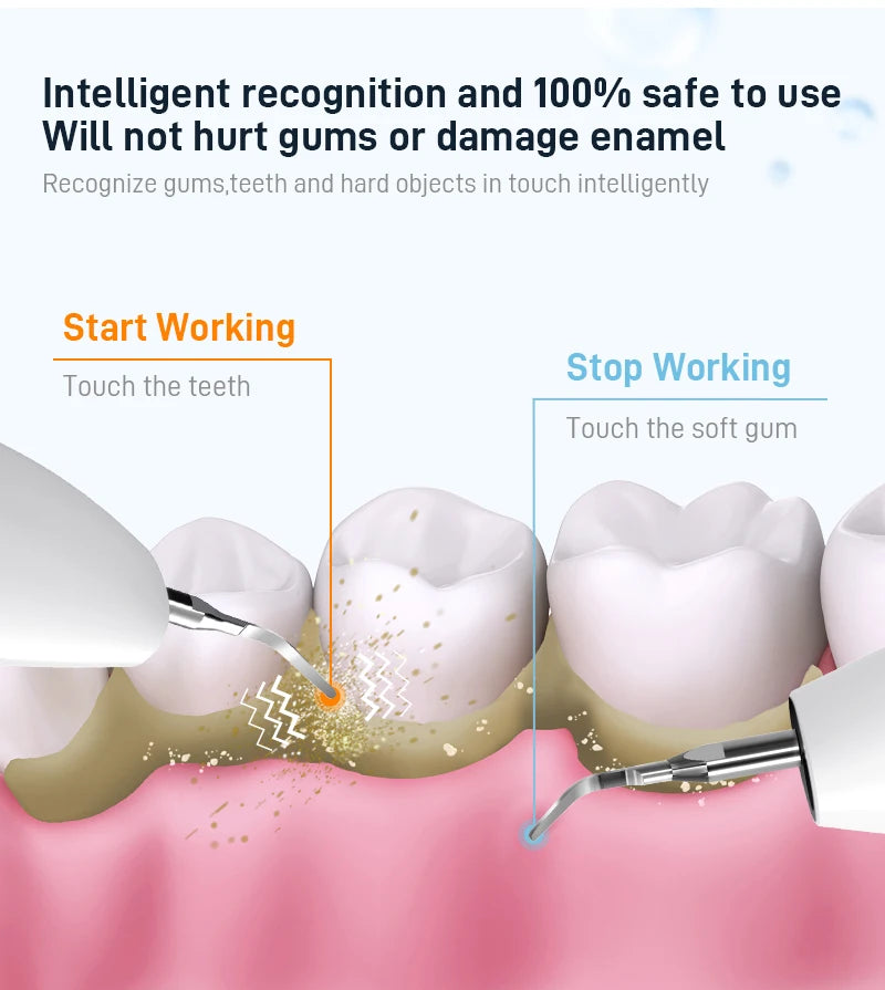 Schoben Ultrasonic Dental Scaler | Tartar & Plaque Remover | Electric Tooth Stone Cleaner