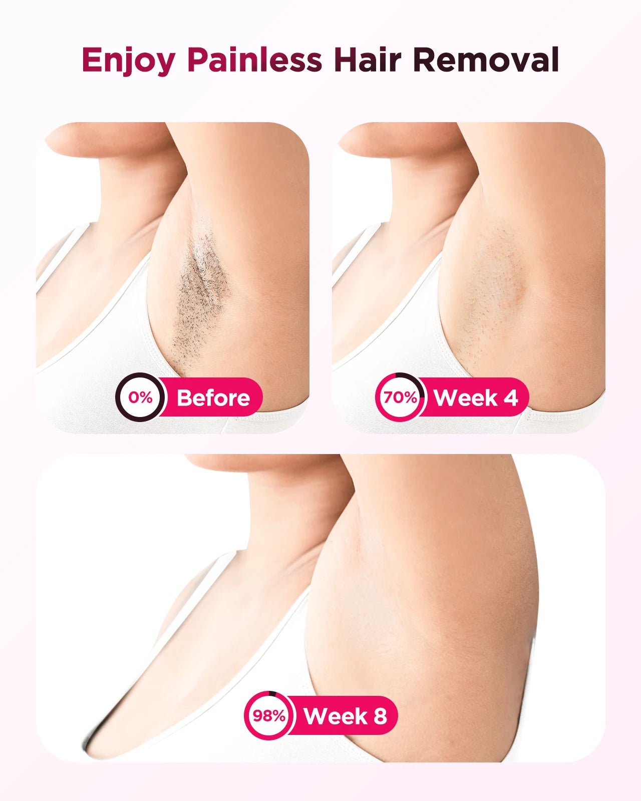 IPL Hair Removal Device – 990,000 Flashes, Permanent Painless Hair Remover for Men & Women, Body & Face