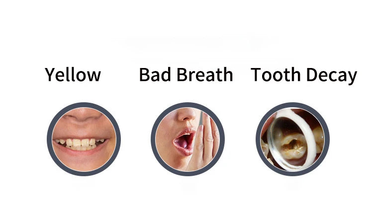 360° U-Type Automatic Electric Toothbrush – Ultrasonic, Rechargeable, Blue Light, IPX7 Waterproof | Adults
