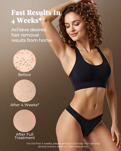 JOOYEE IPL Hair Removal Device – 999,900 Flashes, 9 Levels, HR/SC/RA Modes, Painless At-Home Laser Epilator for Women